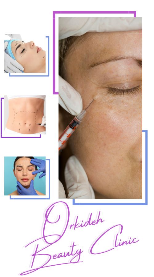 مرکز زیبایی ارکیده