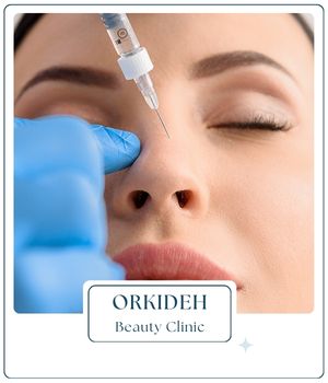 ماندگاری ژل و فیلر ماندگاری ژل و فیلر