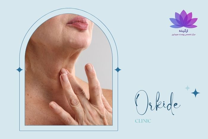 لیفت گردن برای چه سنی مناسبتر است؟ لیفت گردن برای چه سنی مناسبتر است؟