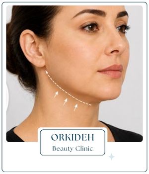 ماندگاری نتایج لیفت چانه و گردن چقدر است؟