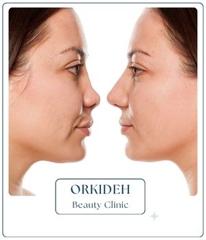 مزایای جراحی بینی ترمیمی مزایای جراحی بینی ترمیمی
